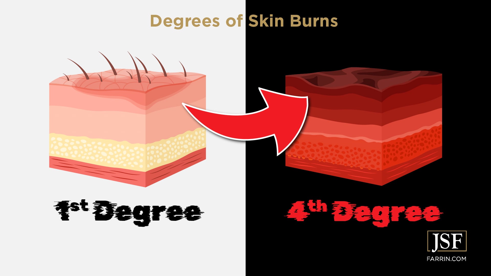 How Burn Injury Claims Work in North Carolina